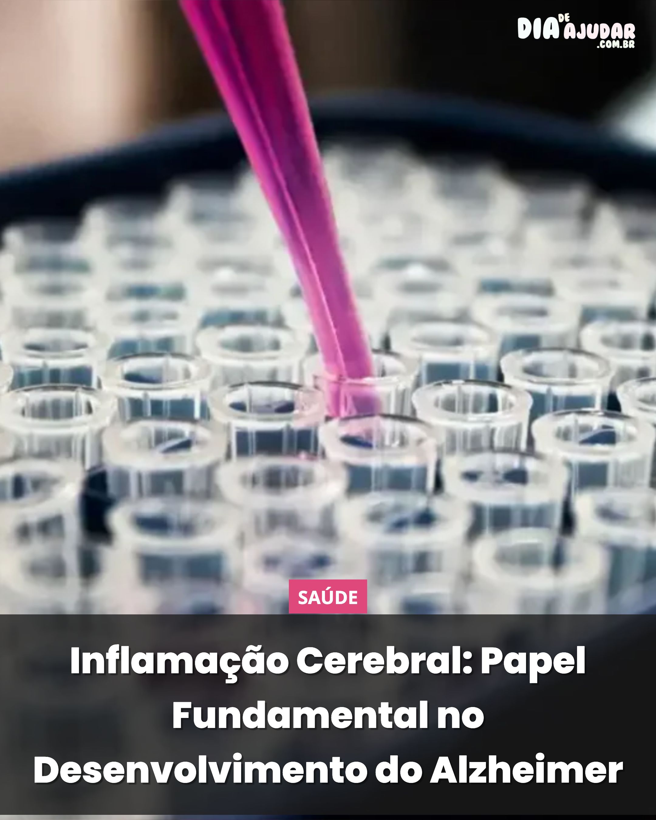 Inflamação Cerebral: Papel Fundamental no Desenvolvimento do Alzheimer